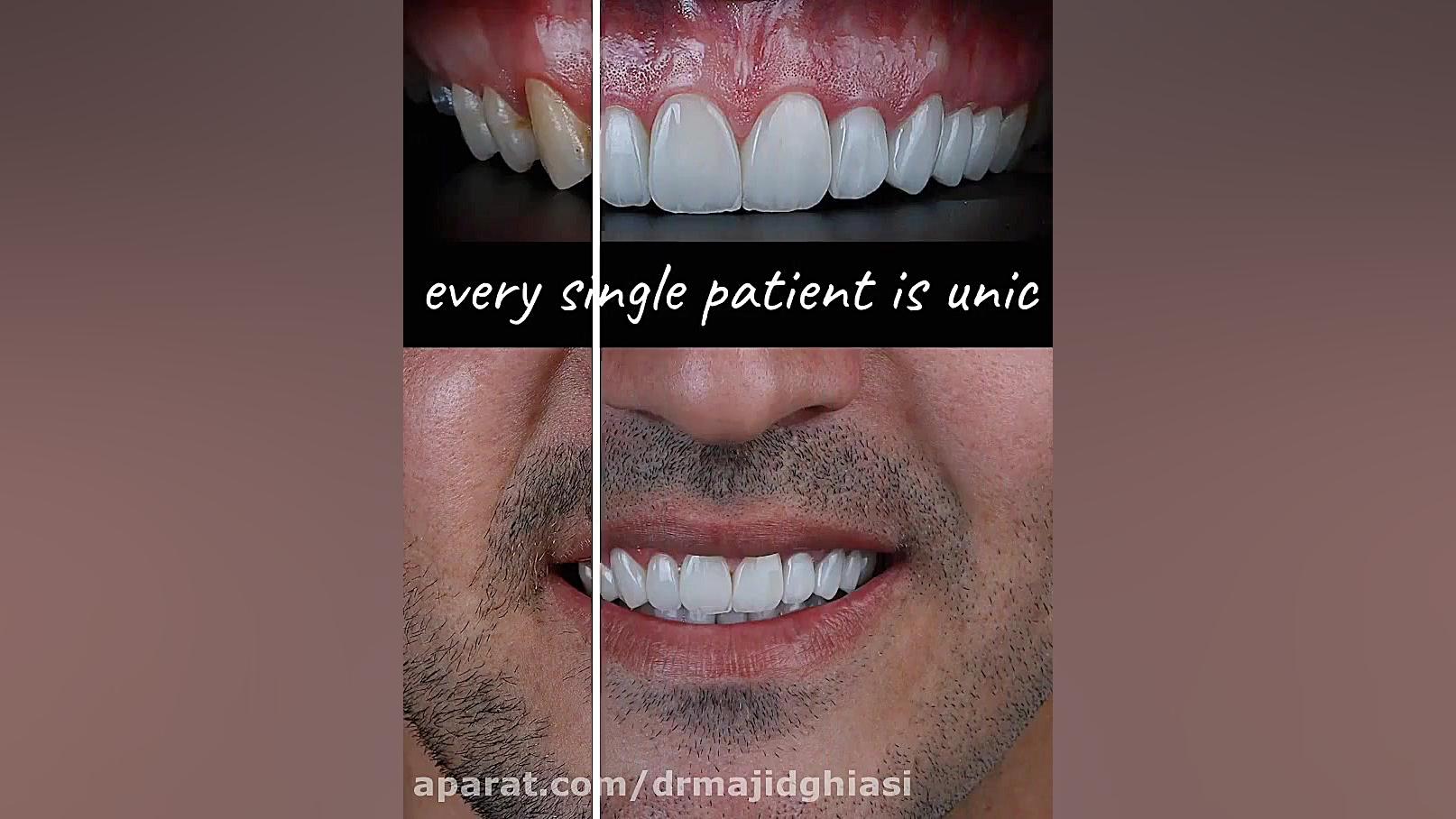اصلاح طرح لبخند دکترمجیدقیاسی