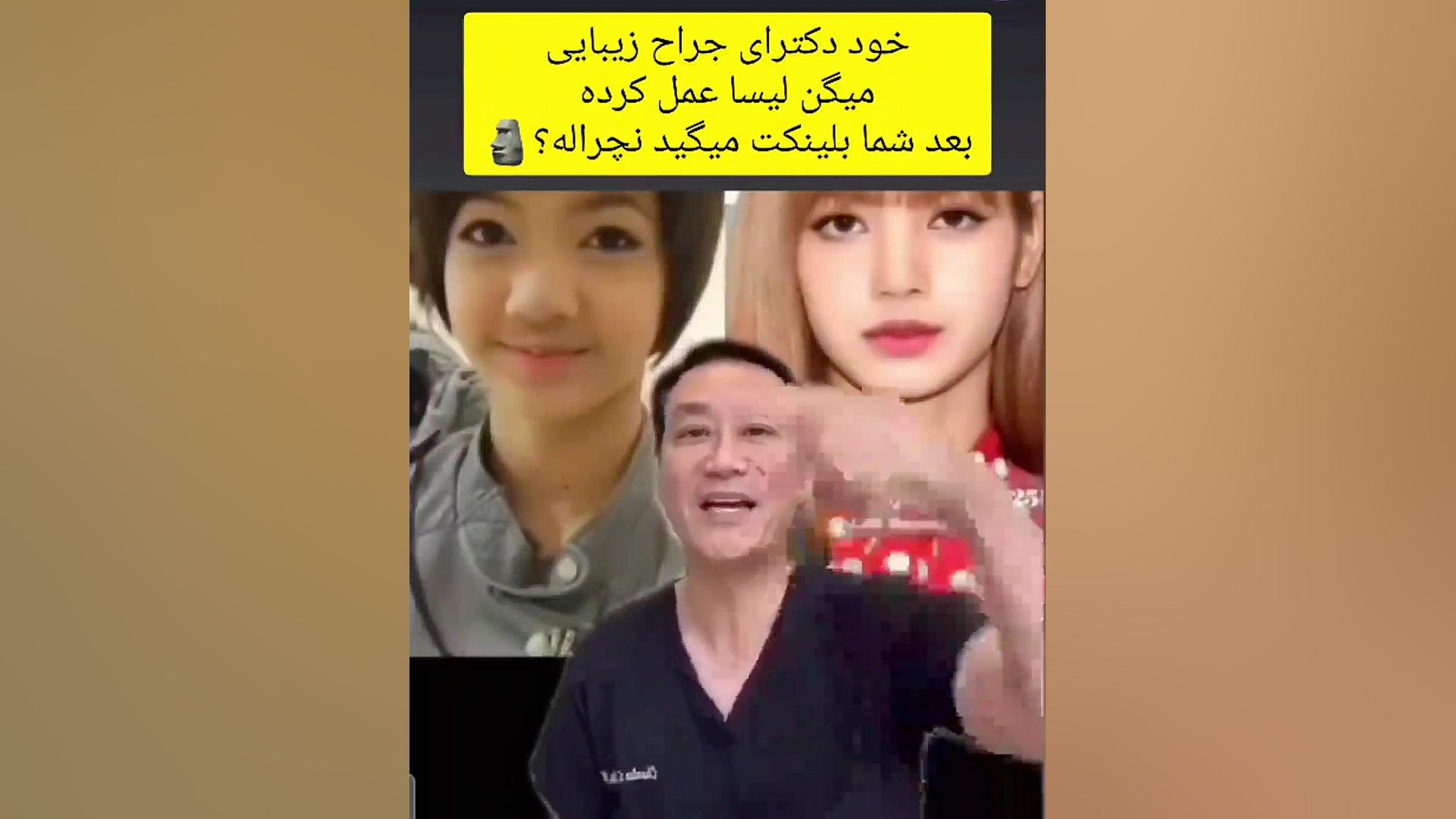 بلک پینک/ لیسا / عمل زیبایی لیسا/ لیسا بلک پینک درمان سلول‌های بنیادی