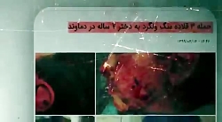 برشی از سریال آقای قاضی با موضوع حمله سگی که توسط صاحبش در پارک رها شده بود/ این برشی از سریال آقای قاضی با موضوع حمله سگی که توسط صاحبش در پارک رها شده بود/ این