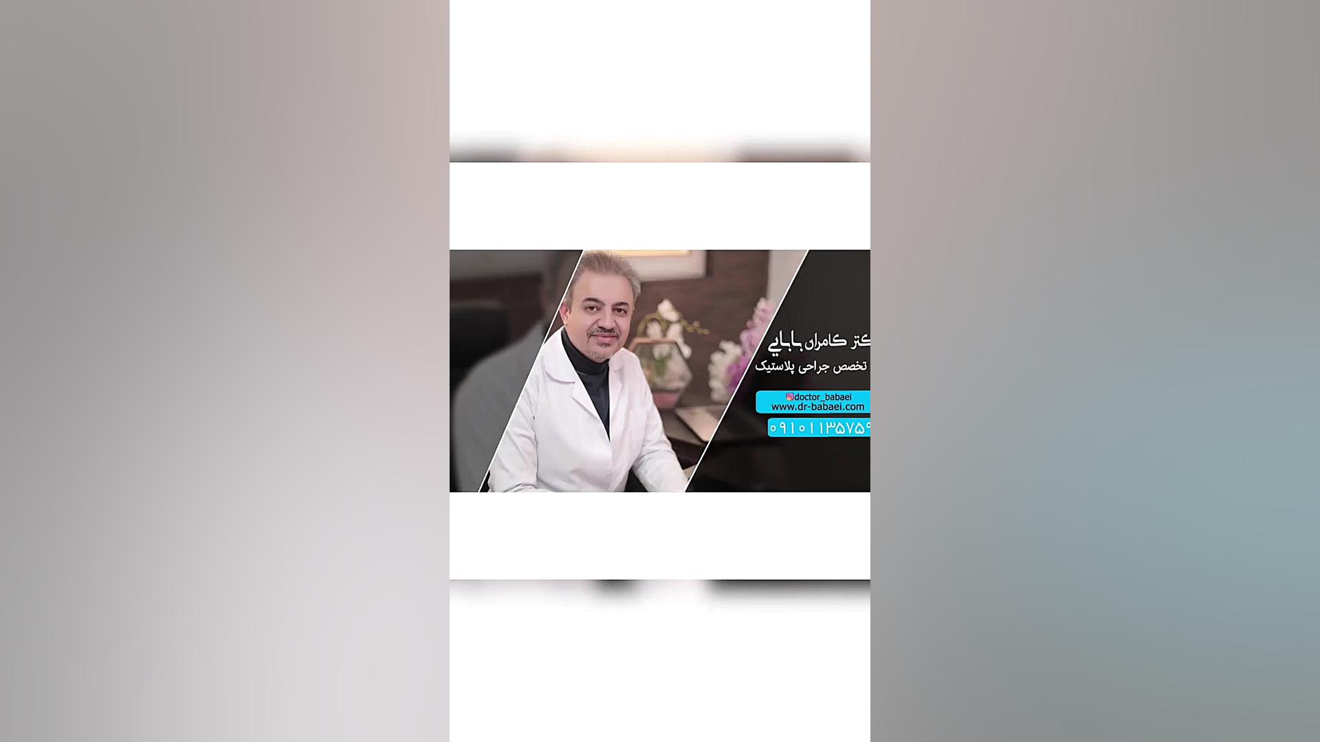 فیلم واقعی نتیجه جراحی رینوپلاستی دکتر کامران بابایی