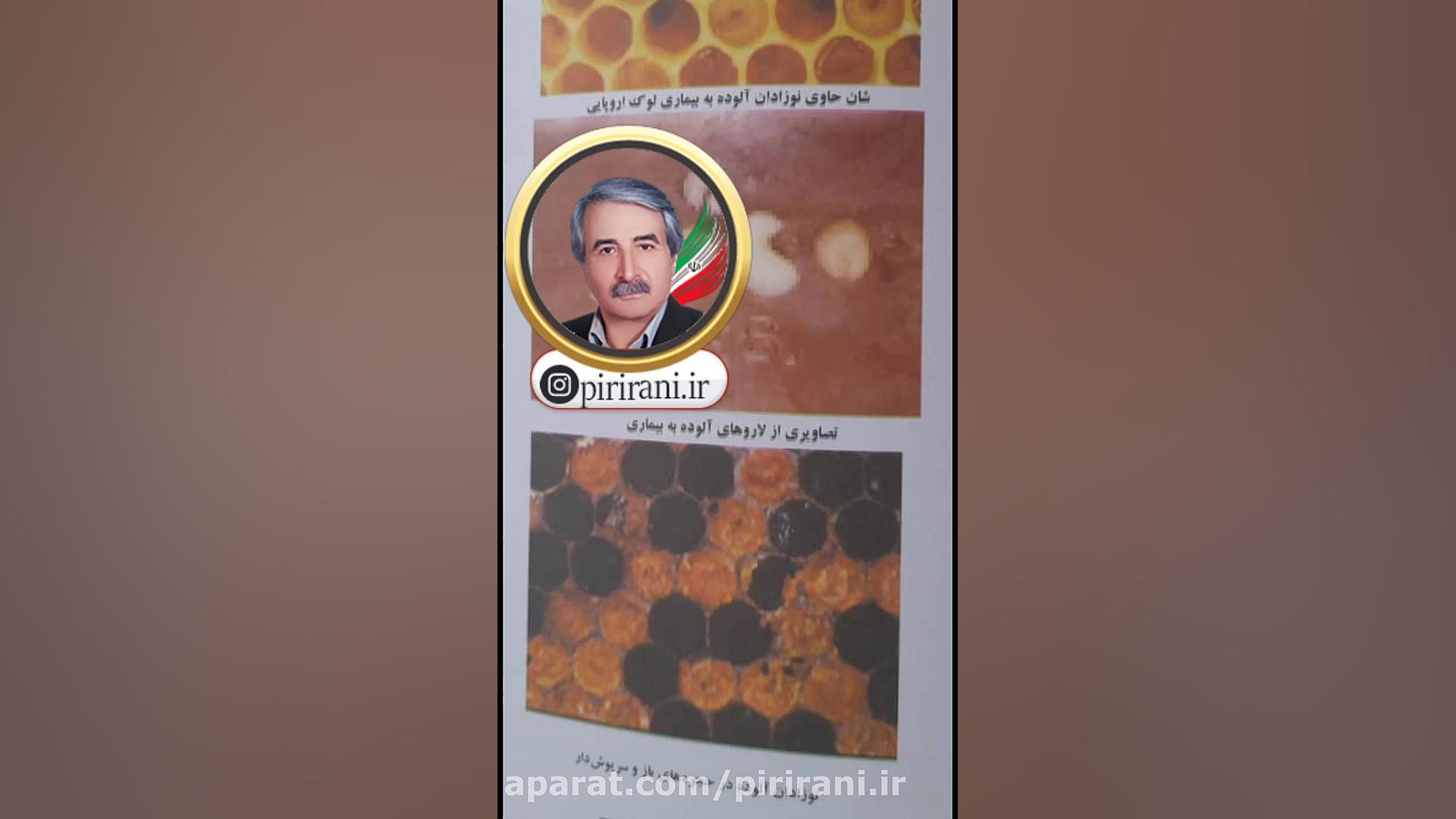 عامل بیماری لوک اروپایی(صحبت های مهندس پیر ایرانی) پلی‌داکتیلی