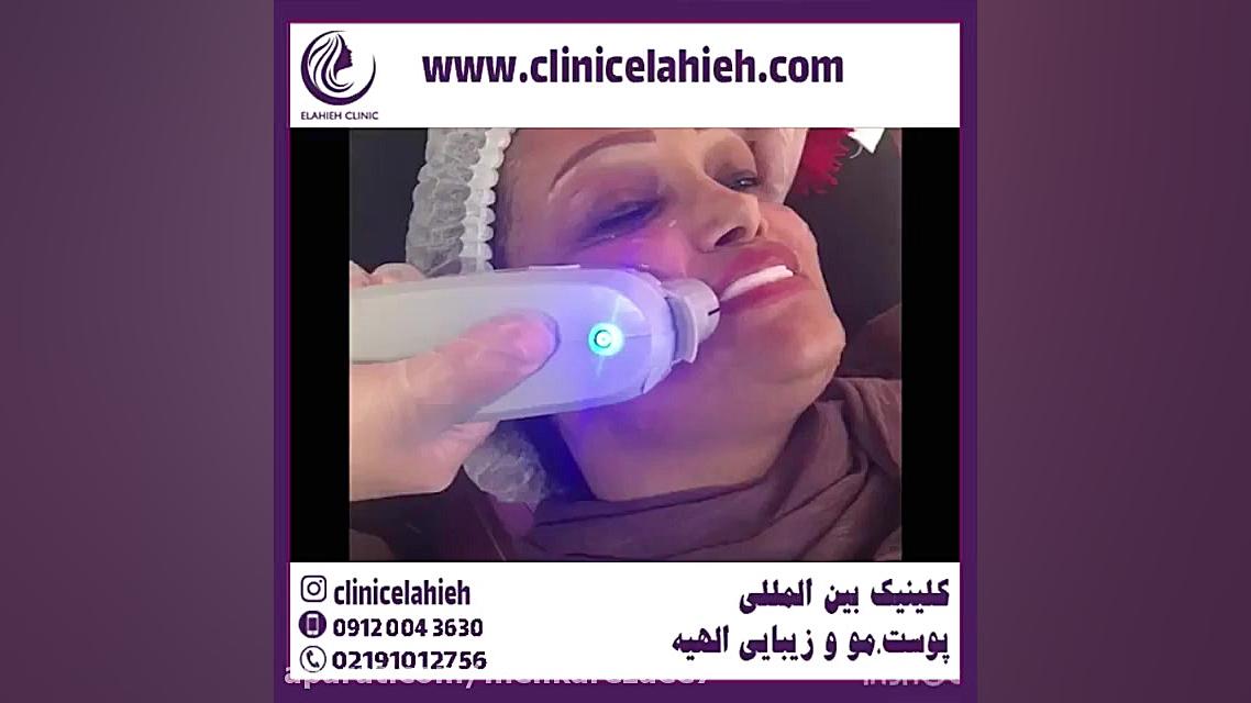 بهترین دکتر هایفوتراپی Anti-CCP