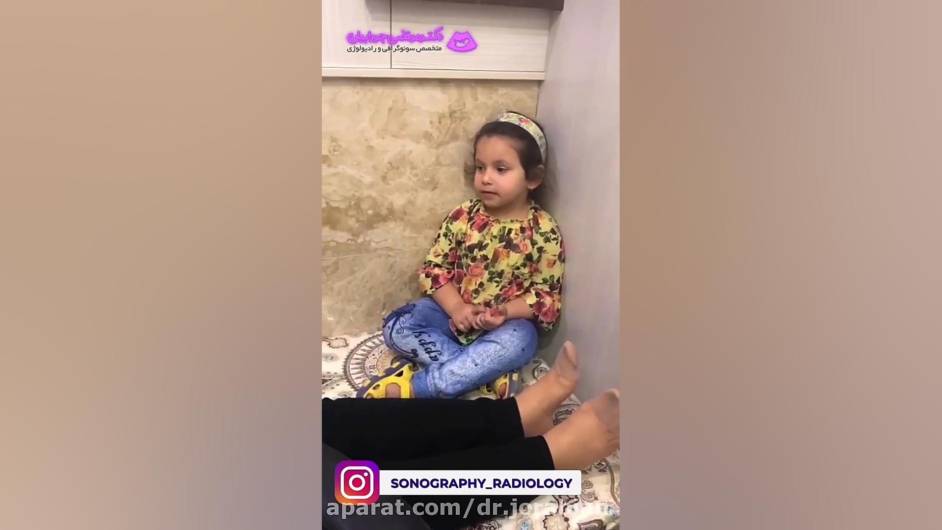 انجام سونوگرافی آنومالی هایفوتراپی