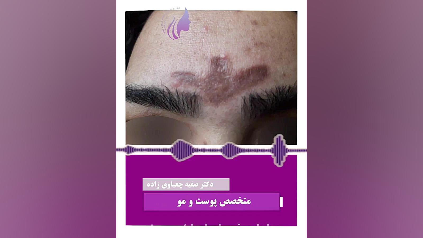 توصیه های عالی دکتر صفیه چعباوی زاده ... دکتر صفیه چعباوی زاده