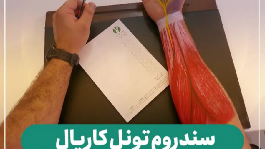 درمان سندروم تونل کارپال مچ دست یا سندرم CTS Synaptic Vesicle Tracking