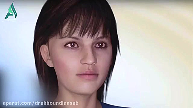 ژنیوپلاستی - جراحی چانه دکتر محمدرضا آخوندی نسب-فوق تخصص جراحی پلاستیک