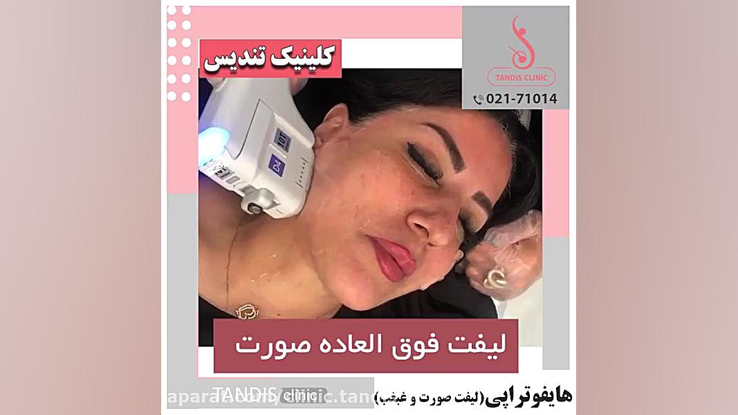 توضیحات کامل و‌مفید در مورد هایفوتراپی بیماری کاوازاکی