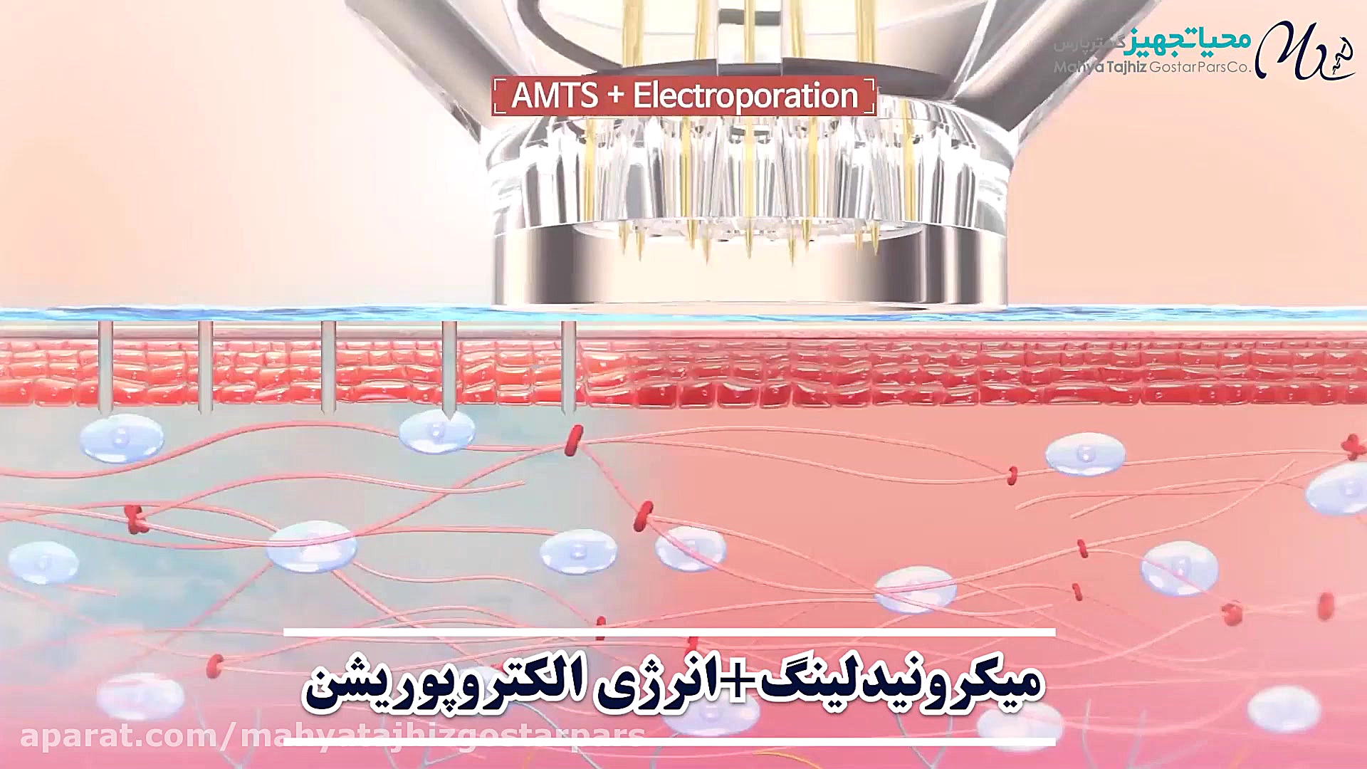تفاوت میکرونیدلینگ با الکترونیدلینگ EPN دندانپزشک زیبایی