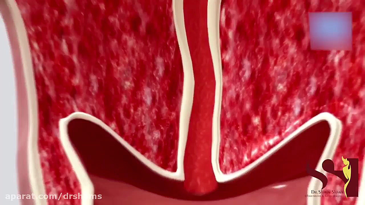 دلیل دیر رسیدن به ارگاسم دکتر شیرین شمس جراح و متخصص زنان و زایمان