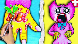 درمان تاول دست  کیسی میسی چه ا...