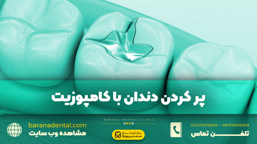 "پر کردن دندان با کامپوزیت چگونه انجام میشود؟" کلینیک زیبایی
