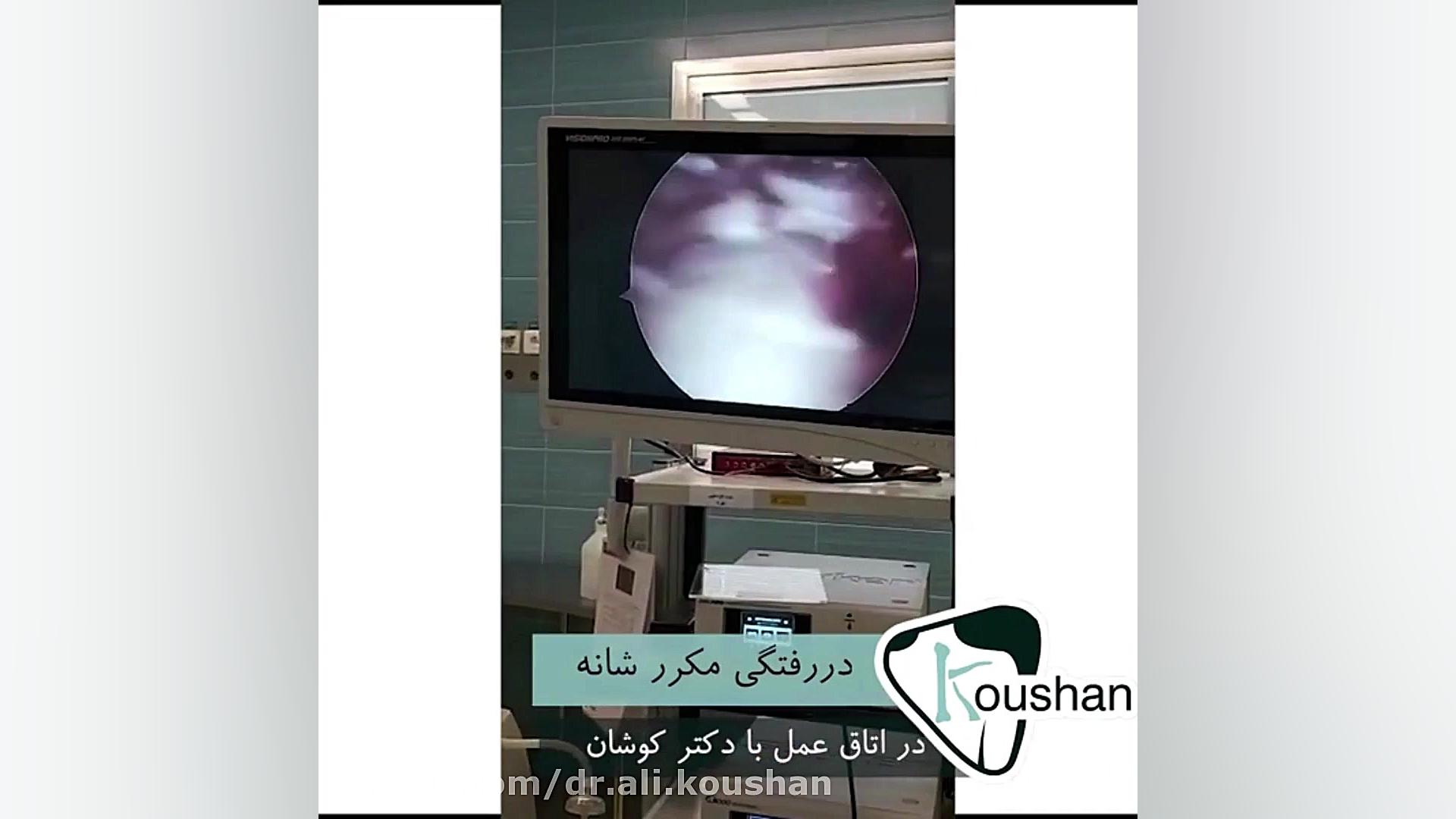 جراحی ترمیم دررفتگی مکرر شانه جنیفر لوپز