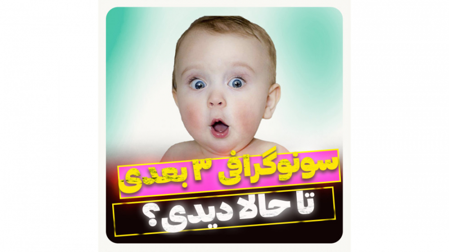 تاحالا سونوگرافی 3بعدی دیدید؟ گلابی زرین
