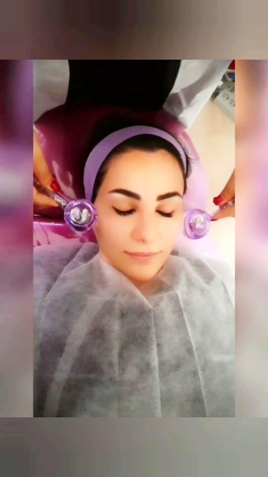 ماساژ صورت با گوی یخ در کلینیک پوست امیدوار