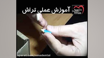 تراش دندان برای پرسلن لمینت دیسکرازی خون
