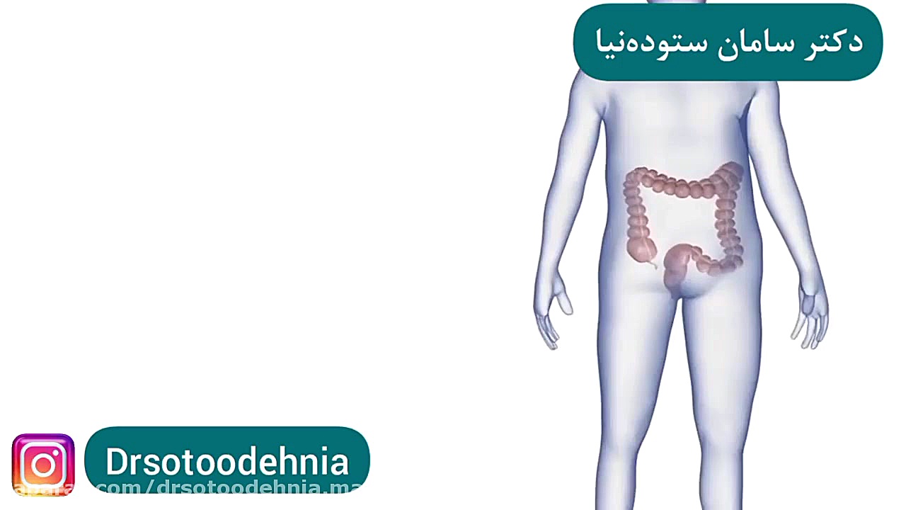 کولونوسکوپی پیلینگ شیمیایی