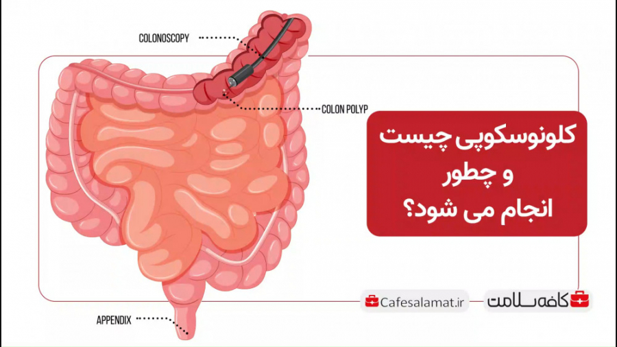 کلونوسکوپی چیست و چطور انجام می شود؟ جراحی زیبایی پلک