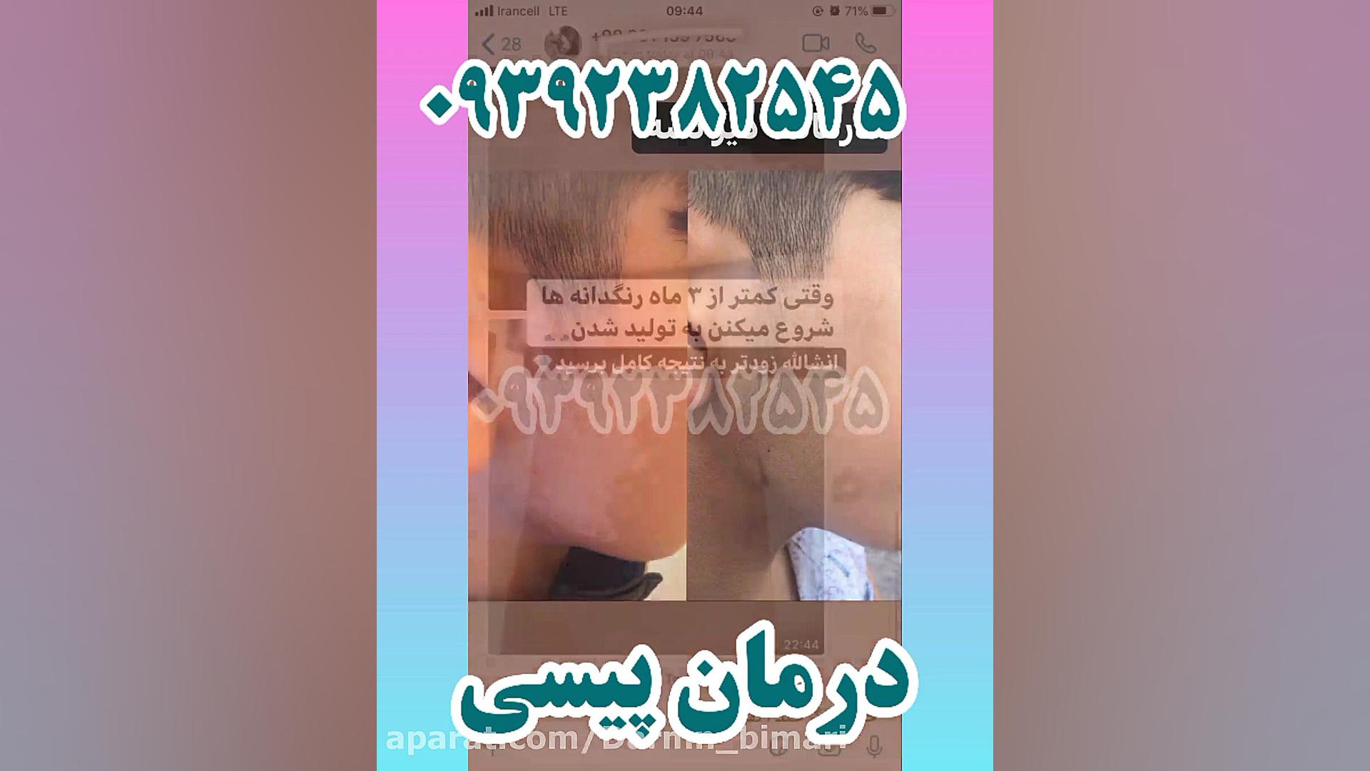 درمان پیسی مهران مدیری