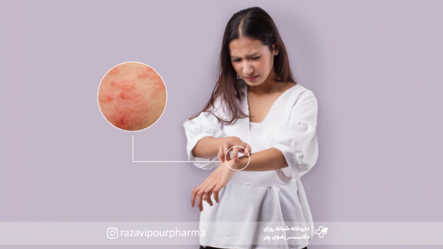 علائم شایع درماتیت آتوپیک محسن یگانه