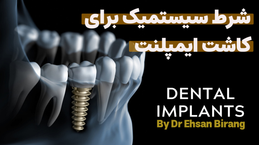 شرایط سیستمیک بدن و all on 4 جهت کاشت دندان به روش دیجیتال | دکتر احسان بیرنگ دکتر احسان بیرنگ