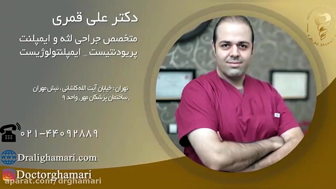 افزايش طول تاج زيبايى دندان هاى فك بالا دکتر علی قمری - متخصص جراحی لثه و ایمپلنت