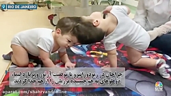 جدا کردن موفقیت آمیز دوقلوهای به هم چسبیده برزیلی با استفاده از واقعیت مجازی جدا کردن موفقیت آمیز دوقلوهای به هم چسبیده برزیلی با استفاده از واقعیت مجازی
