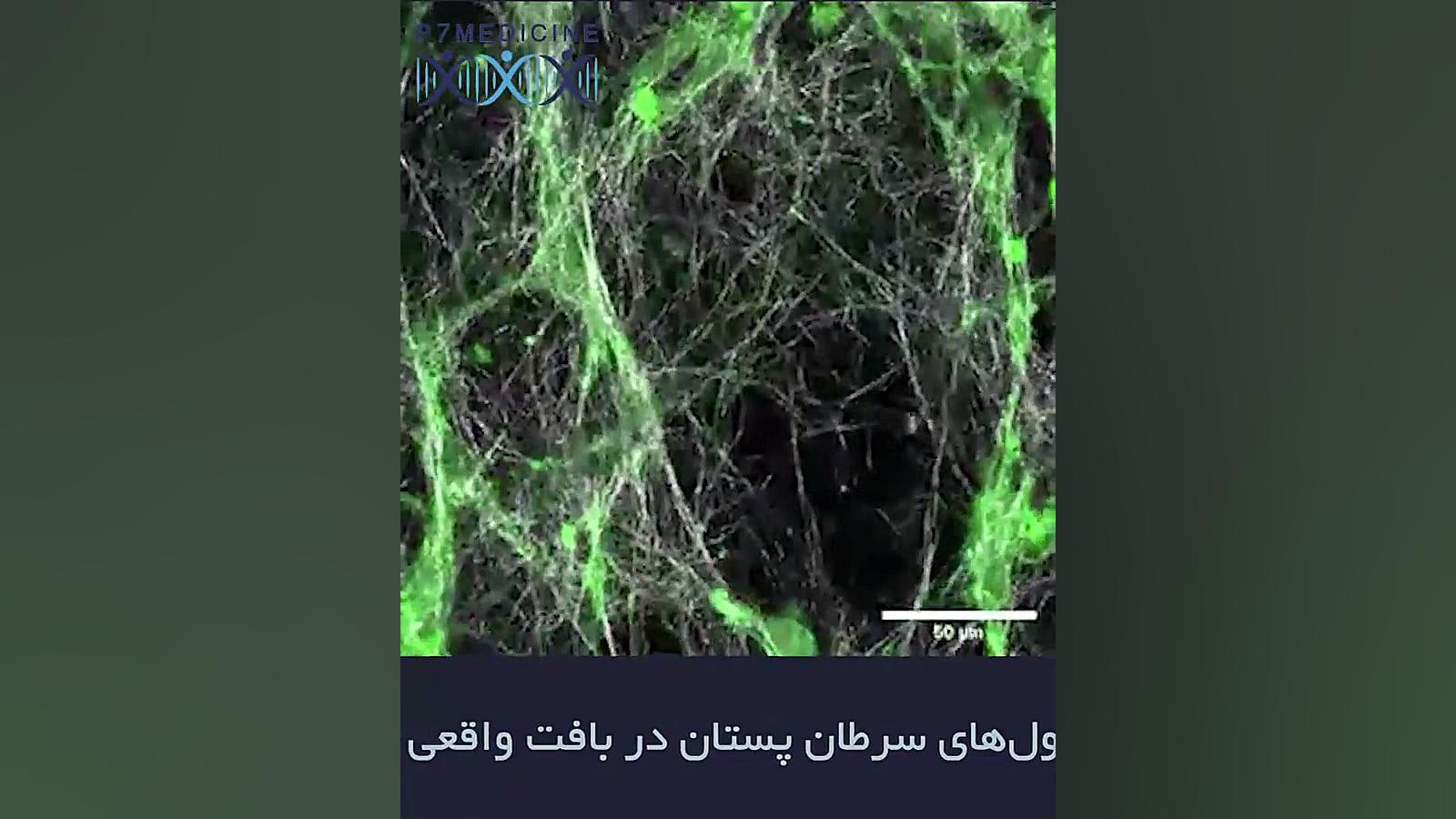 سلول‌های سرطان پستان در بافت واقعی علیرضا طلیسچی