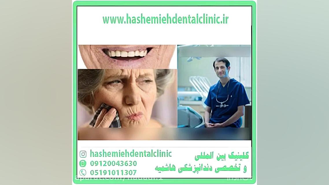 چگونه از دندان مصنوعی خود مراقبت کنیم؟ CUT&Tag