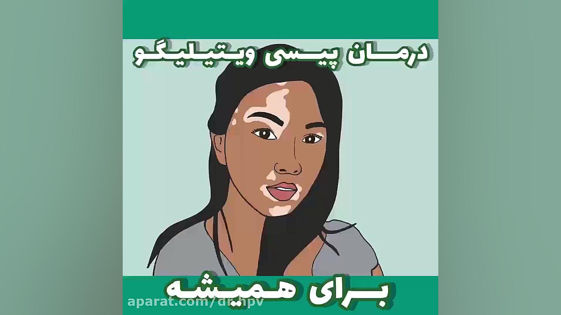 درمان پیسی ویتیلیگو بدون بازگشت الناز شاکردوست