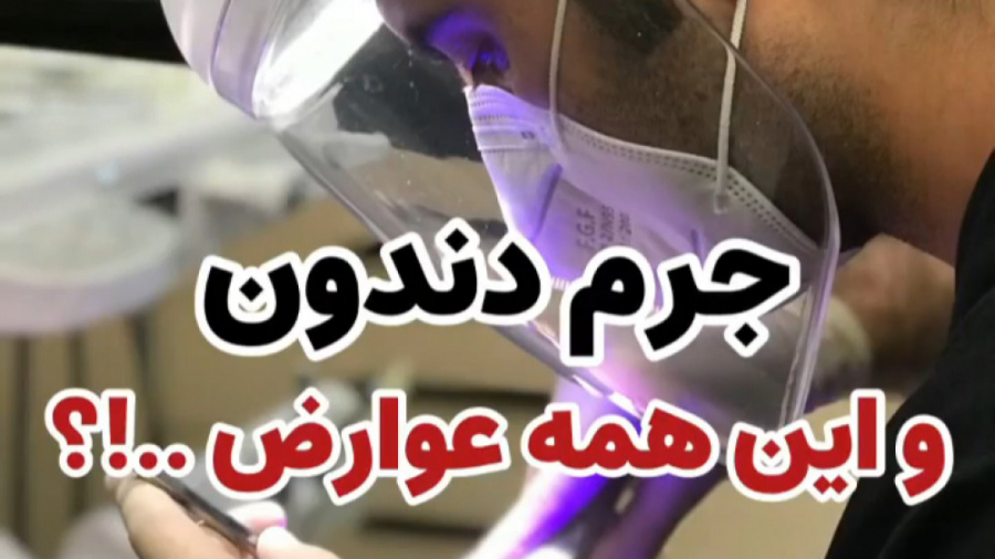 جرم دندون و این همه عوارض؟! _ دکتر رضا شهریاری _ دندانپزشک _ مشهد دکتر رضا شهریاری دندانپزشک - مشهد