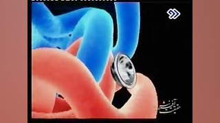 اعجاز آفرینش در هموگلوبین ، معجزه قرآن کریم کاردیومگالی