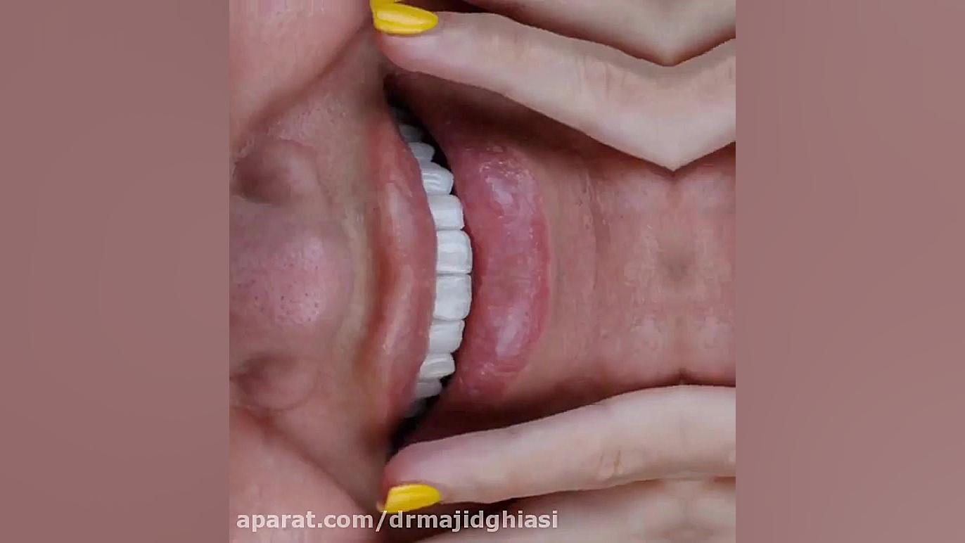 اصلاح طرح لبخند دکترمجیدقیاسی