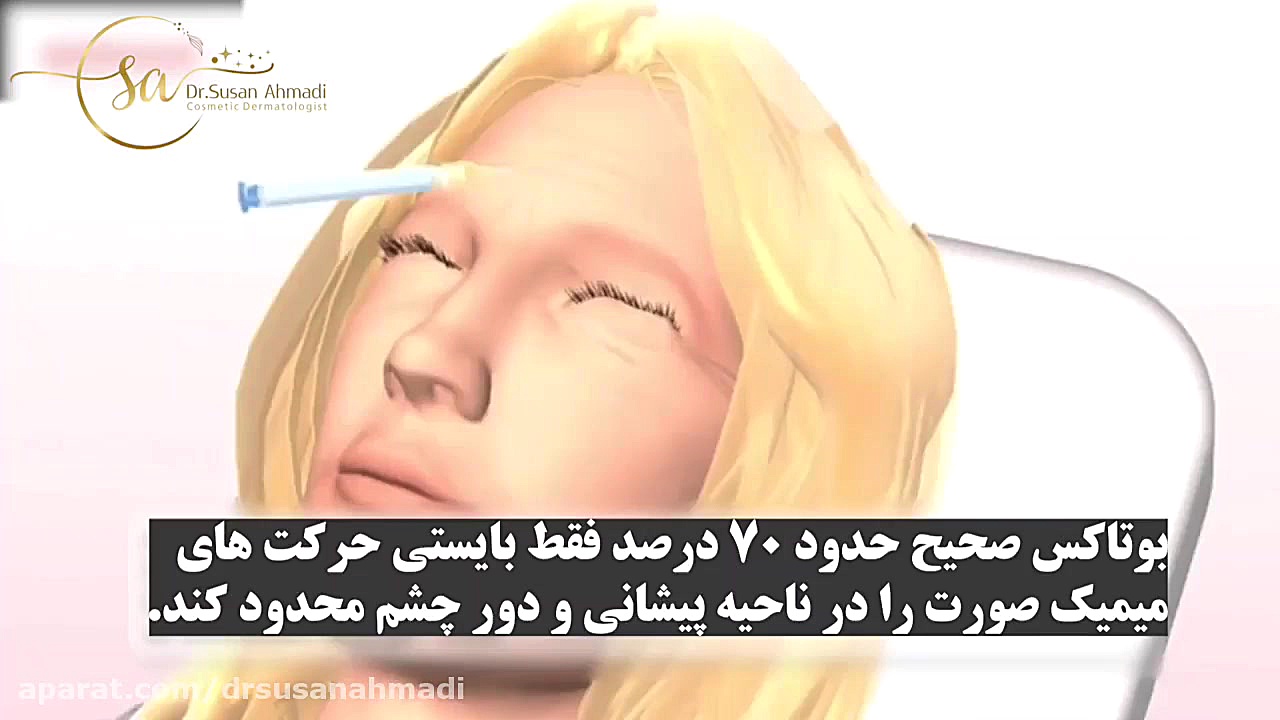 بوتاکس صورت دکتر سوسن احمدی پیر شهید