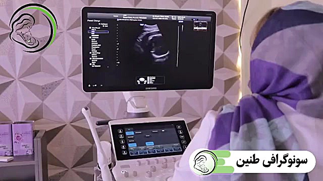 در سونوگرافی سه ماهه سوم بارداری چه مواردی بررسی می شود؟ اما استون