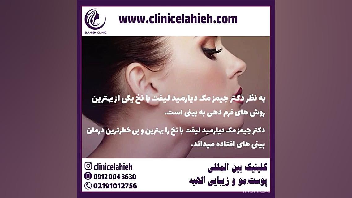 لیفت بینی با نخ در تهران جراحی گوش