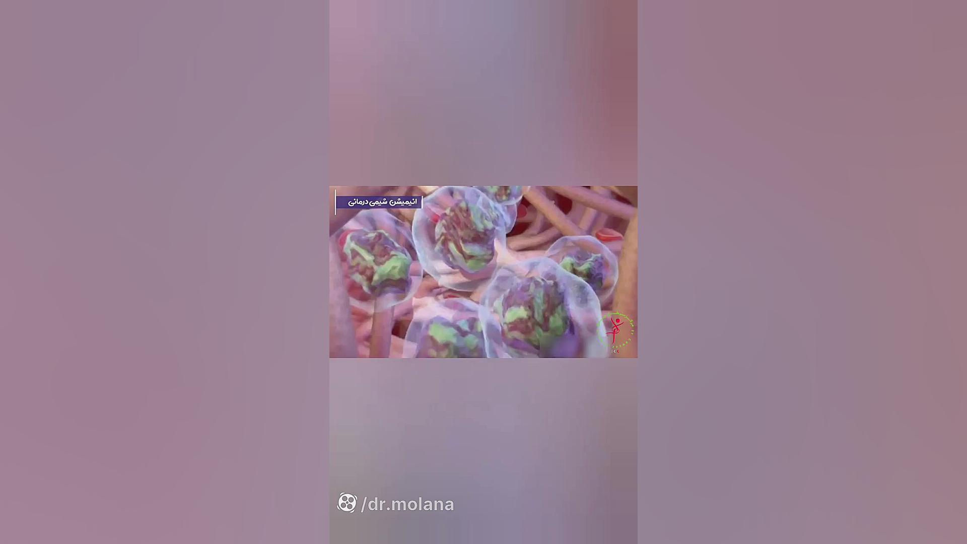 شیمی درمانی رادیوگرافی دندان