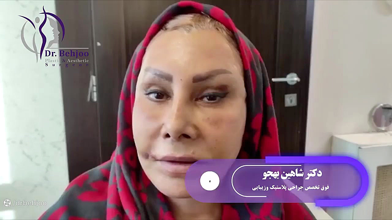 لیفت صورت و لیفت اندوسکوپیک ابرو دستگاه آنالیز ایمیجینگ سلول زنده