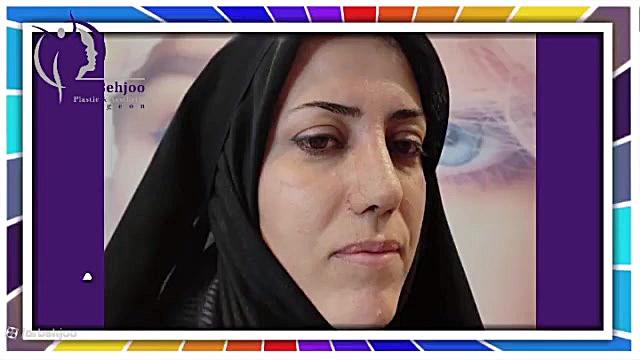 جراحی بینی طبیعی و این همه تغییر دکتر شاهین بهجو - فوق تخصص جراحی پلاستیک