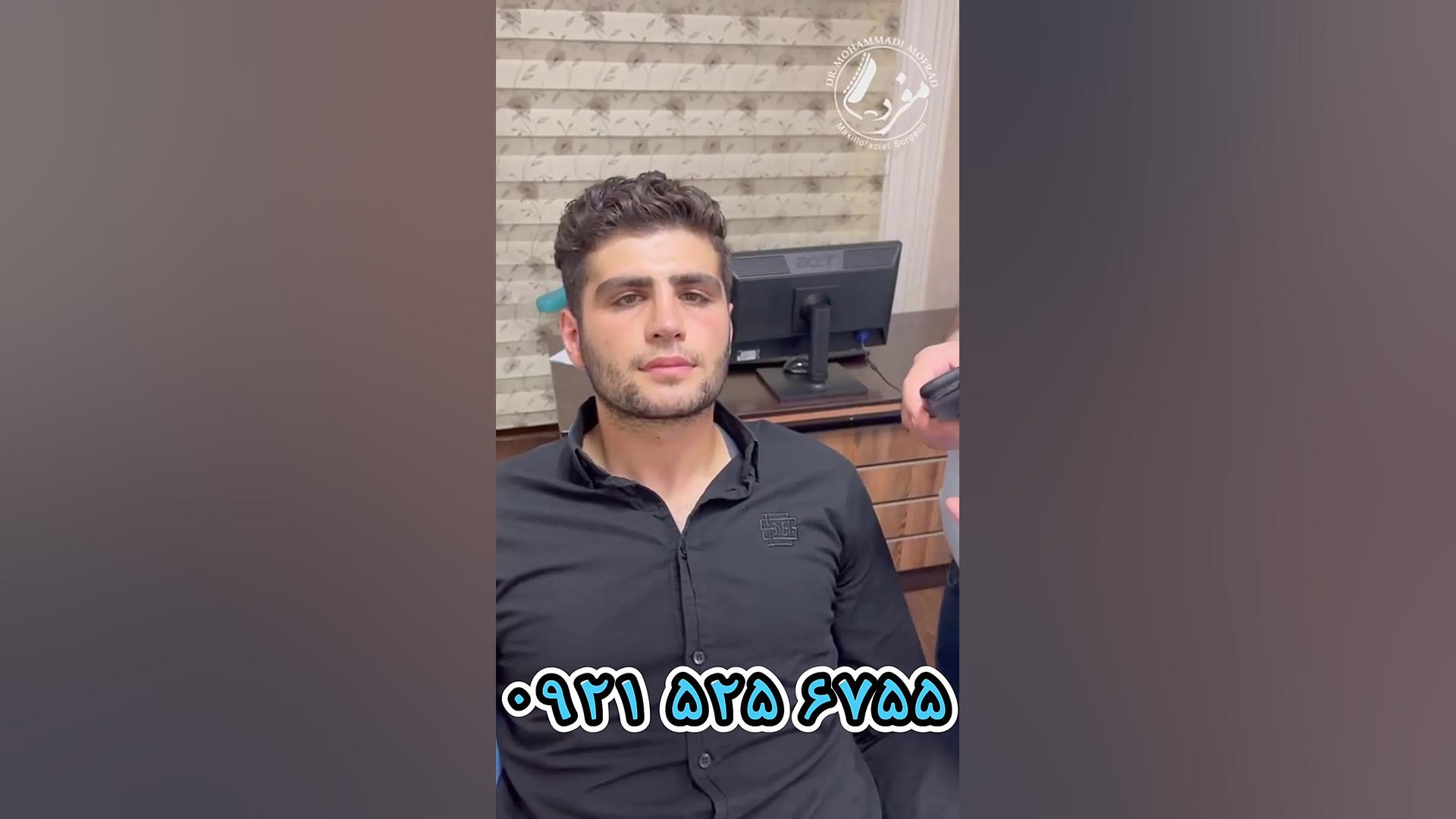 جراحی بینی دیگر توسط دکتر محمدی مفرد دکتر امیر حسین محمدی مفرد