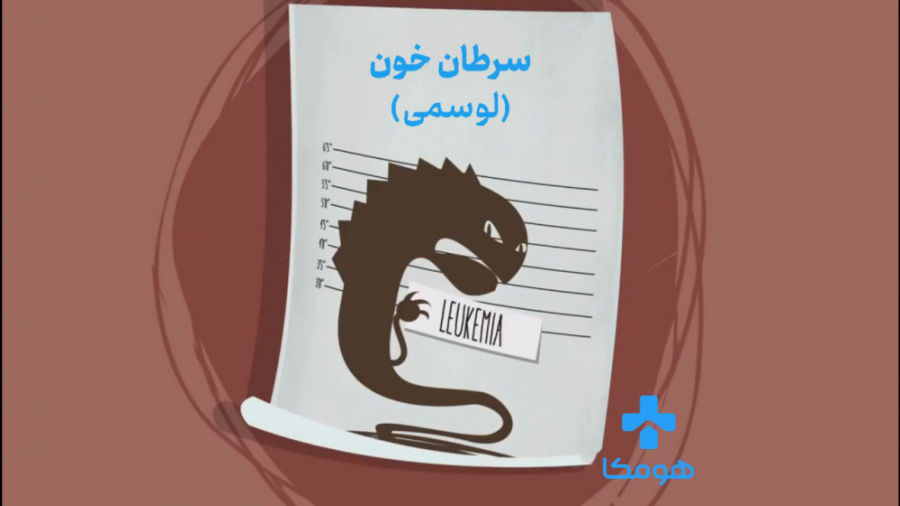 سرطان خون (لوسمی) دندانپزشکی کودکان
