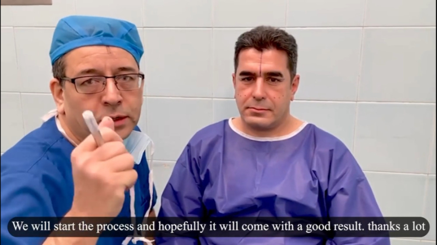 لیفت صورت در مردان پیلینگ