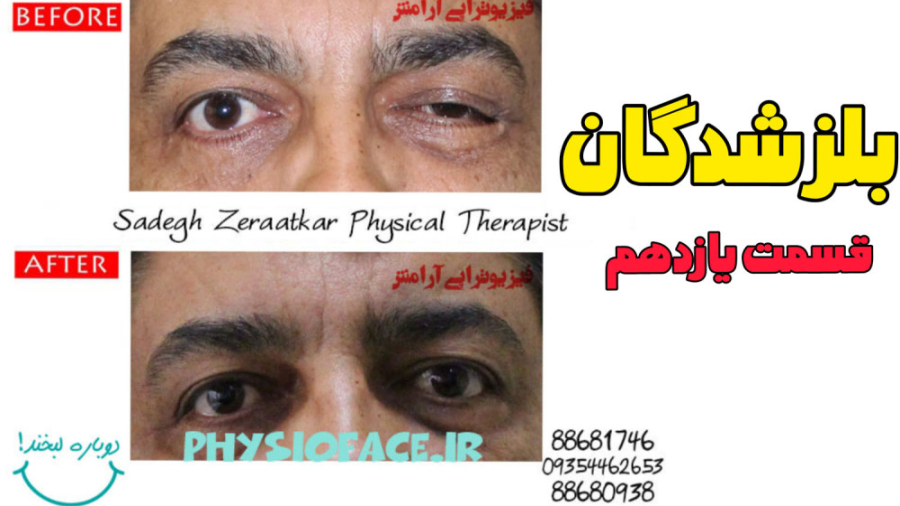 متخصص فیزیوتراپی فلج بلز دندانپزشک زیبایی