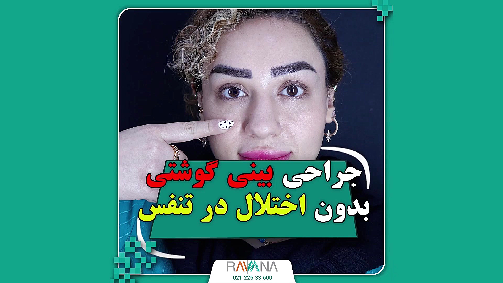 جراحی بینی گوشتی به سبک نیمه فانتزی پوشش زخم هیدروکلوییدی