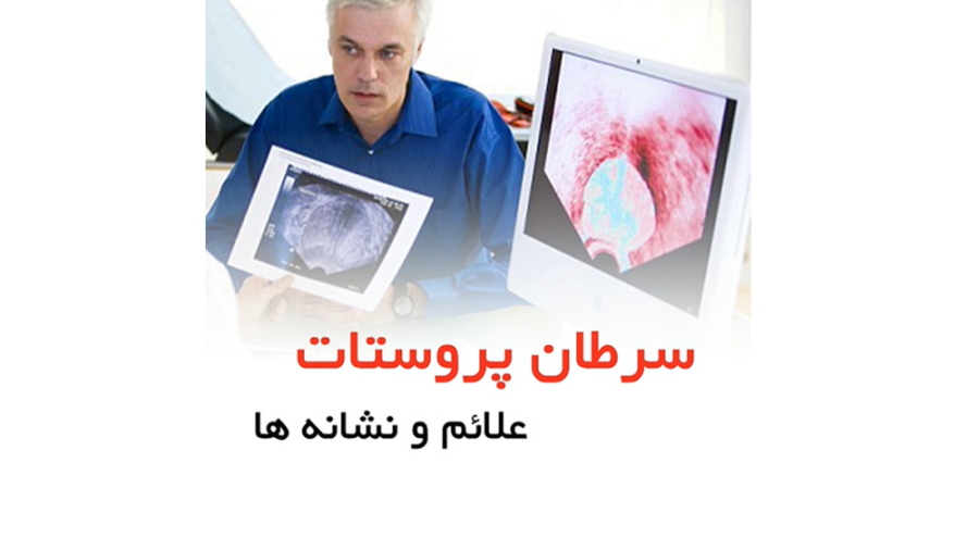 سرطان پروستات علائم و نشانه ها _ دکتر سید امین میرصادقی اینستاگرام
