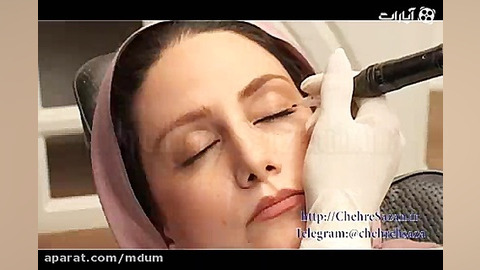 آموزش تاتوی خط چشم(میکروپیکمنتیشن) روکش دندان