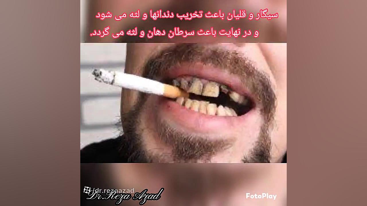 دکتر رضا آزاد:جرم گیری، اثرات دخانیات و عفونت لثه دکتر رضا آزاد