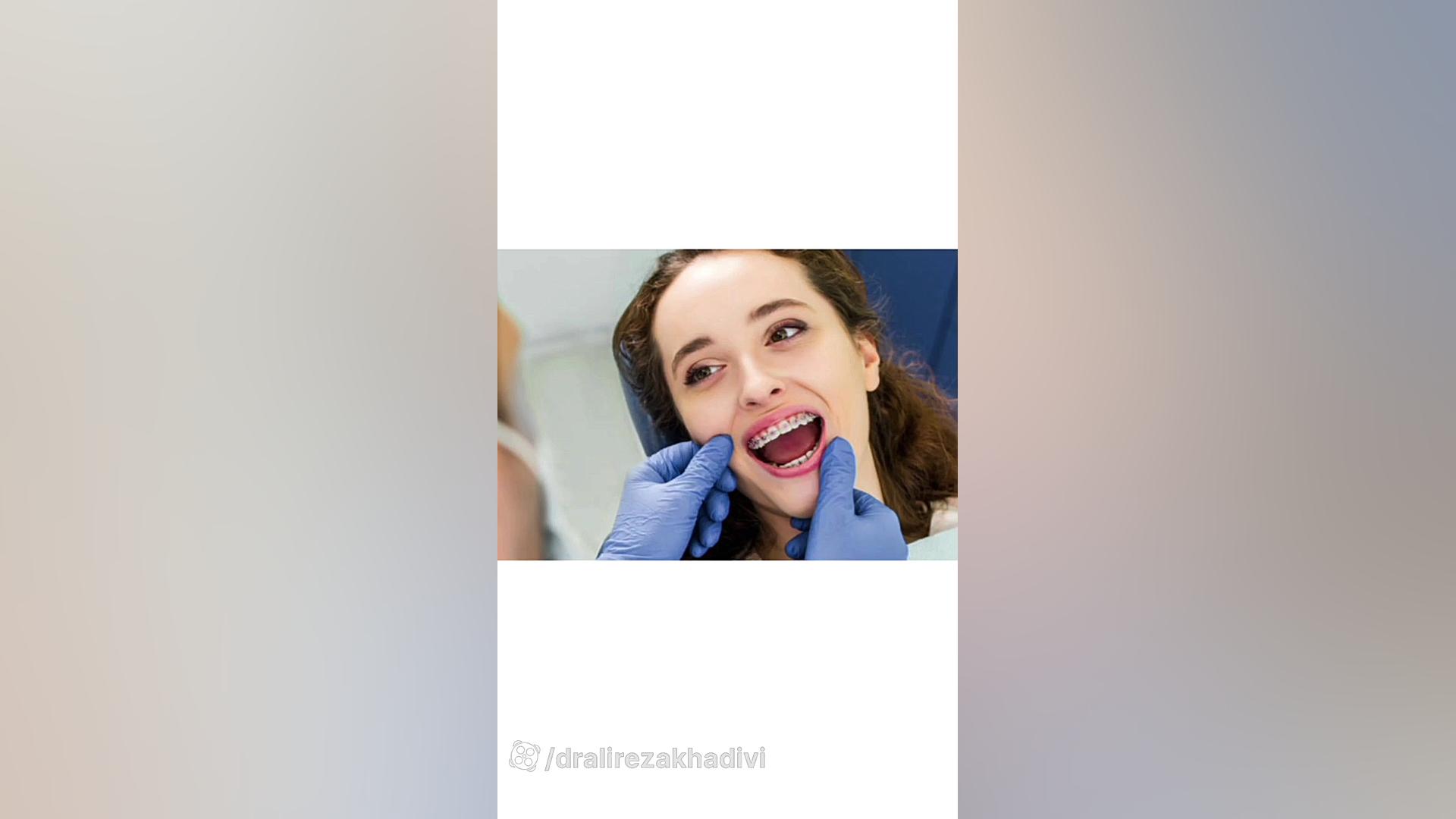 برای درمان ارتودنسی حتما باید دندان کشید؟دکترعلیرضاخدیوی متخصص ارتودنسی دکتر علیرضا خدیوی