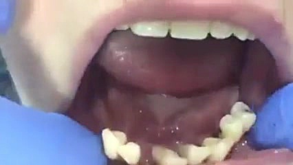 بیماری های لثه دکترمجیدقیاسی