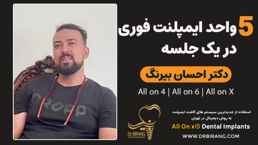 5 واحد ایمپلنت فوری در یک جلسه |دکتر احساب بیرنگ متخصص ایمپلنت تهران 5 واحد ایمپلنت فوری در یک جلسه |دکتر احساب بیرنگ متخصص ایمپلنت تهران