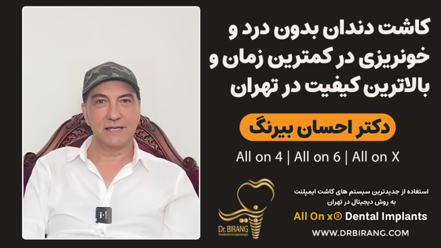 کاشت دندان بدون درد و خونریزی در کمترین زمان و بالاترین کیفیت در تهران دکتر احسان بیرنگ